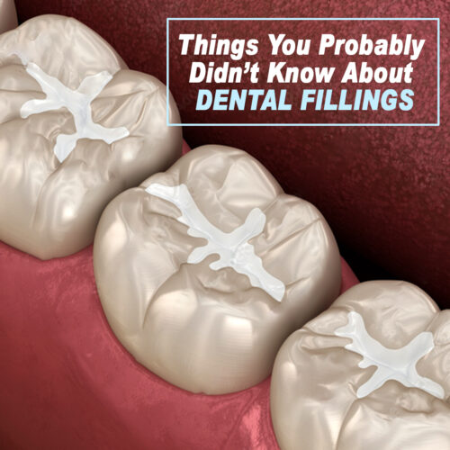 Things You Probably  Didn’t Know About  DENTAL FILLINGS