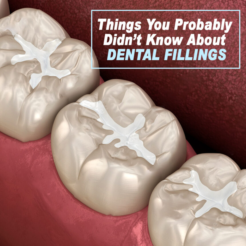 Things You Probably  Didn’t Know About  DENTAL FILLINGS